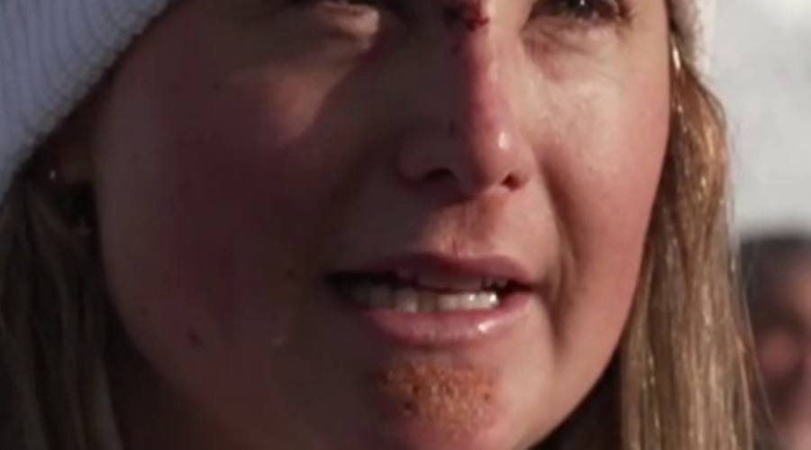 Moioli Wins Olympic Gold 48 Hours After Hospital Visit