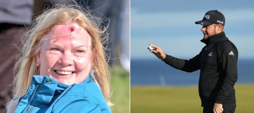 Die Zuschauerin trägt nach dem verzogenen Schlag von Tyrrell Hatton eine deutliche Verletzung davon. (Foto: Twitter/@GolferWandering