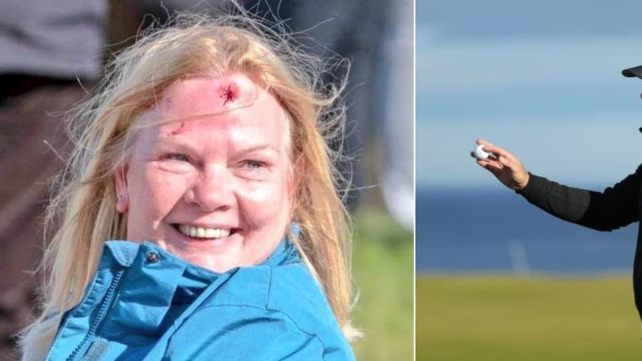 Die Zuschauerin trägt nach dem verzogenen Schlag von Tyrrell Hatton eine deutliche Verletzung davon. (Foto: Twitter/@GolferWandering