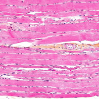 Teste básico sobre sistema muscular