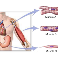 The musculoskeletal system