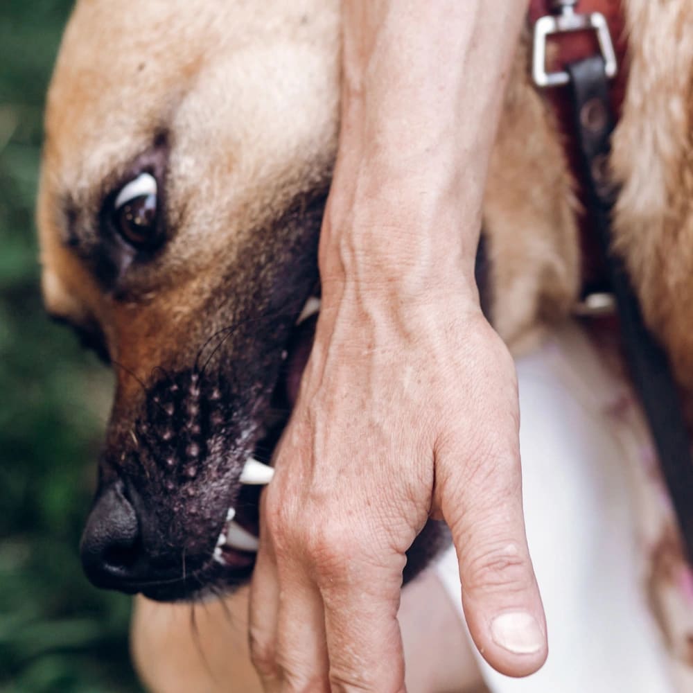 Dog Bite Lawyer Beverly Hills