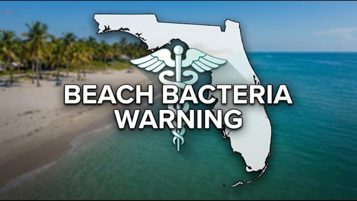4th Florida death reported from Vibrio infection - WKMG
