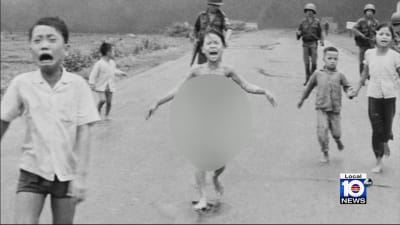 Famous 'Napalm Girl' from defining Vietnam War photo visits South Florida  for last treatment