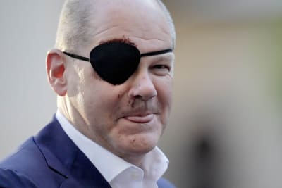 German Chancellor Scholz tweets picture of himself with black eye