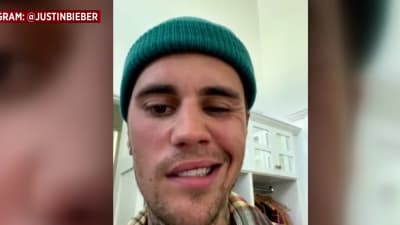 Justin Bieber says he has facial paralysis due to Ramsay Hunt