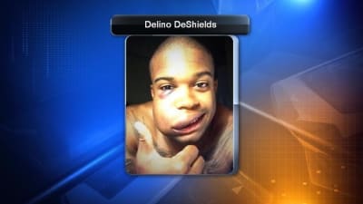 Delino DeShields Jr. -- LIQUID DIET  After Baseball Obliterates Face