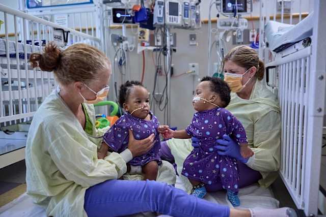 Twin boys born conjoined celebrate 1st birthday after separation surgery