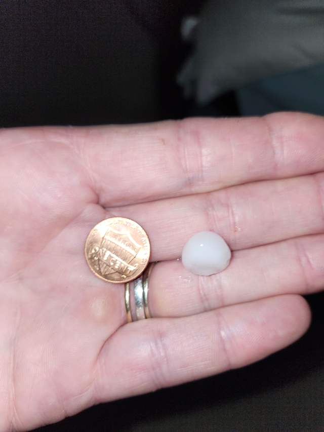 The hail from the severe thunderstorm this morning