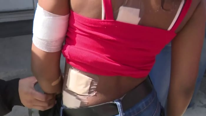 ‘I felt like I was going to die’: 13-year-old says she was stabbed 7 times by another student with pocket knife at Texas City ISD school