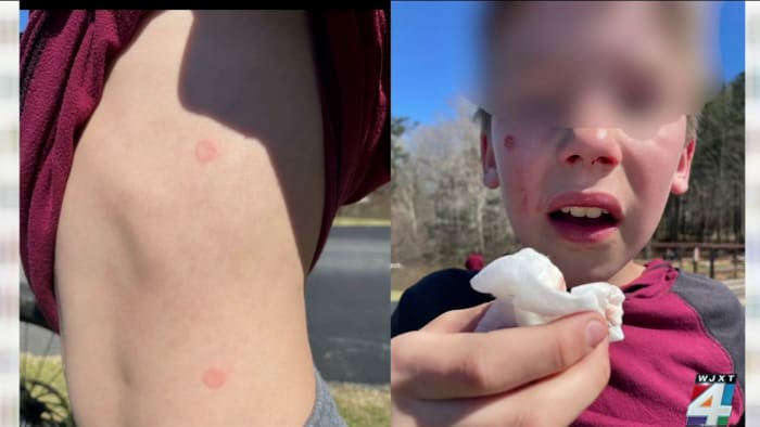 Orbeez Challenge Prompts Warning in Canton – NBC Boston