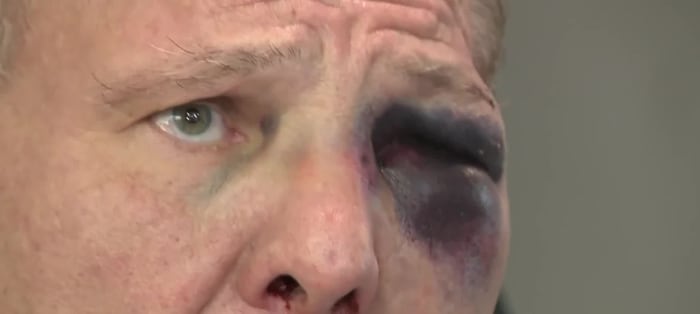 Burglar beats 68-year-old Houston man to bloody pulp after being caught in the act - Vimarsana News