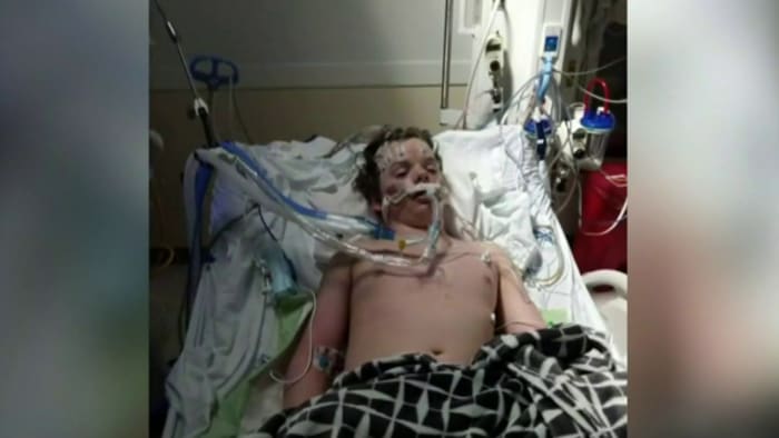 13-year-old dies from ‘Benadryl challenge’ on TikTok
