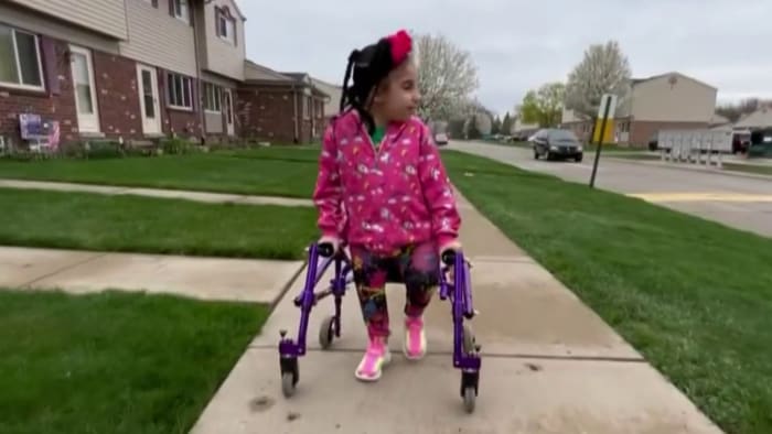 Michigan mom raising money to get 8-year-old daughter with rare birth defects to Florida surgeon - Vimarsana News
