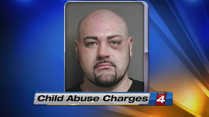 Father Accused Of Abusing 3 Week Old Daughter 1978