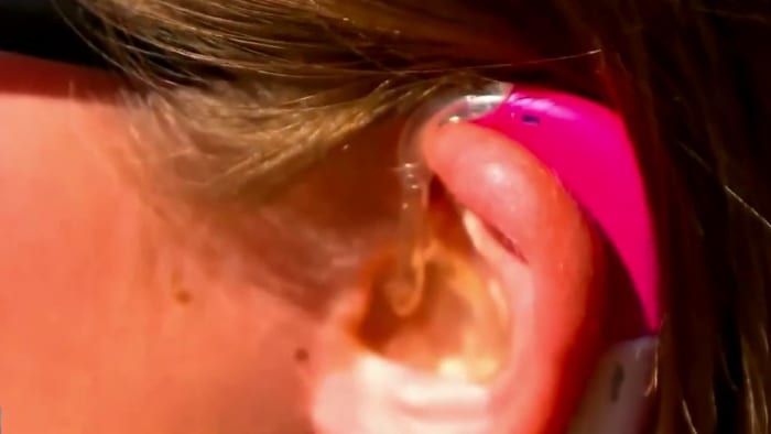🦻OTC vs. prescription hearing aids: What you need to know