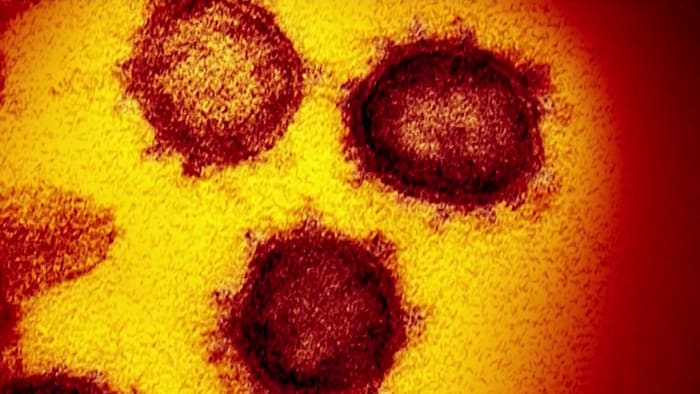 Flying under the radar Houston area doctors seeing uptick in COVID cases