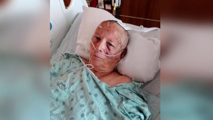 74yearold Liberty County grandmother relives horrifying moment when a pack of dogs viciously attacked her