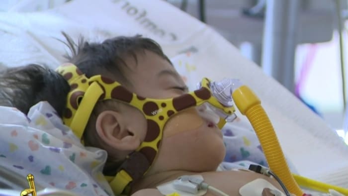 Here’s what parents need to know about RSV as cases continue to rise nationwide
