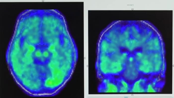 Back To Basics To Boost Brain Health Back To Basics To Boost Brain Health