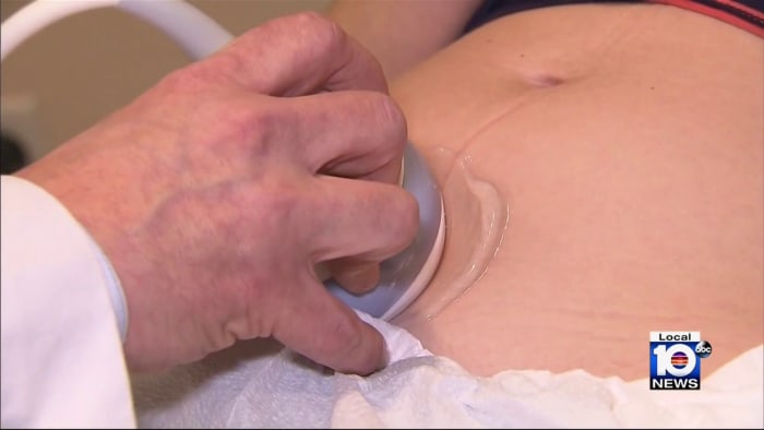 ‘Really traumatic:’ Abortion rights advocates weigh in on Florida’s 6-week abortion ban