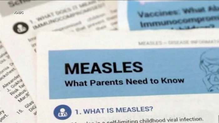 ‘Public health emergency’: Pediatrician criticizes health department after public not alerted quickly to 2 measles cases