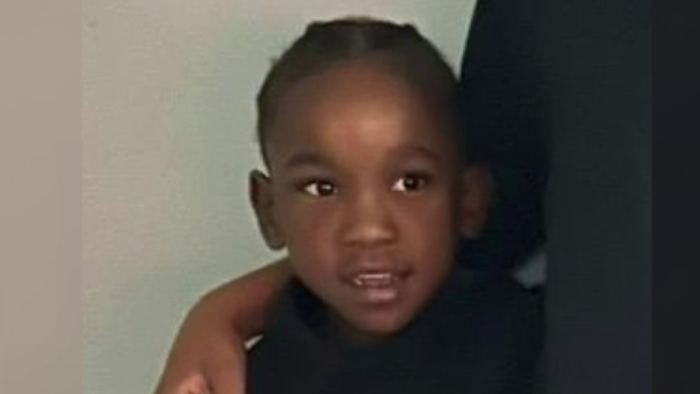 Child faces loss of limbs, long recovery from animal attack on Detroit’s west side