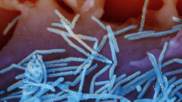 Summer allergies, respiratory viruses, pink eye, eczema