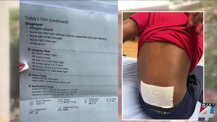Family says unsupervised teammates attacked Duval County middle