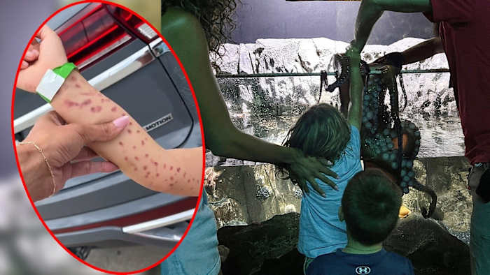 Woman says octopus attacked her 6-year-old son at San Antonio Aquarium, calls for changes