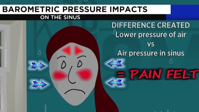 Can changes in the weather cause headaches and pain? | PhillyVoice