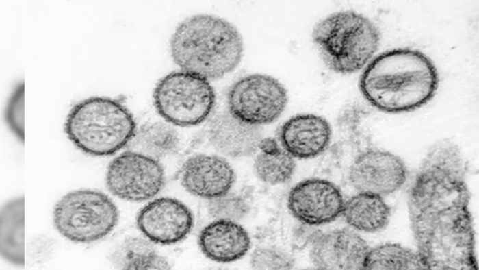 Hantavirus outbreak tied to cruise ship: What Houston-area residents should know