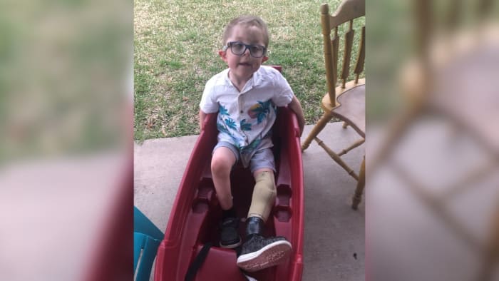 Community pays for new prosthetic leg after 9-year-old loses his in Gulf of Mexico during Galveston vacation