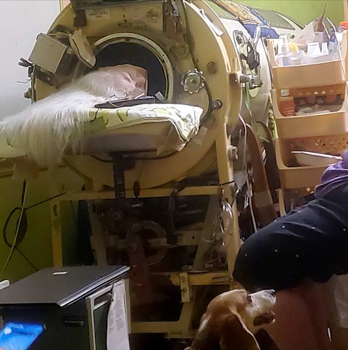 Martha Lillard, last US polio patient using iron lung, dies at 78 in Oklahoma