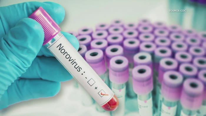 Everything you need to know about norovirus as cases surge in US