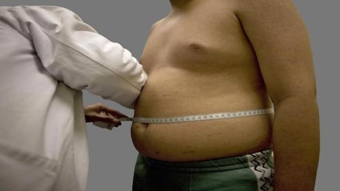 These are the unhealthiest states in the US. Where’s Florida rank?