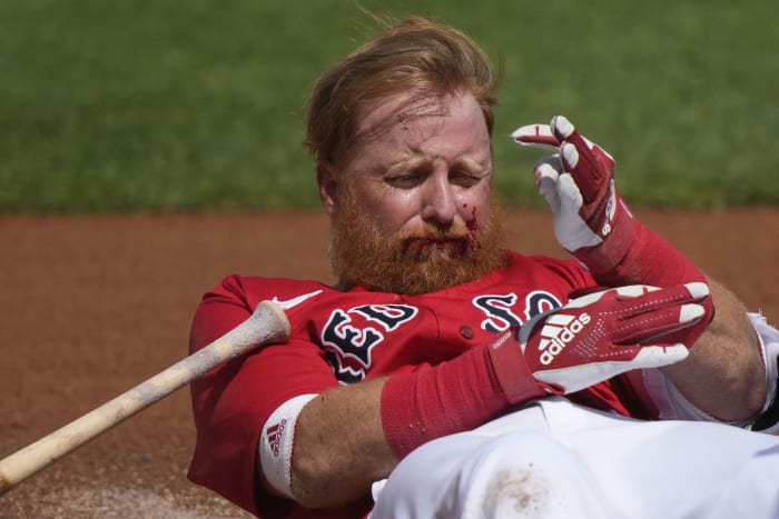 Red Sox pitchers combine for Fenway Park shutout over Royals