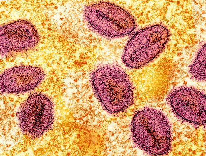 FBI: NIH scientists accused of smuggling monkeypox into US through Detroit Metro Airport