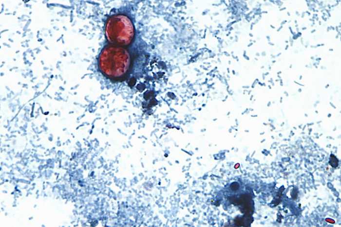 Image linked from the original feed: US health officials are investigating a new outbreak of a diarrhea-causing parasite