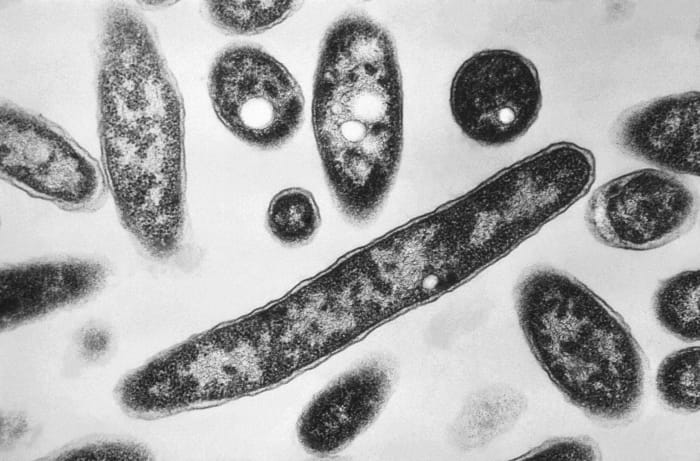 Legionnaires' Disease Outbreak in Dearborn: Wayne County Health Officials Launch Investigation