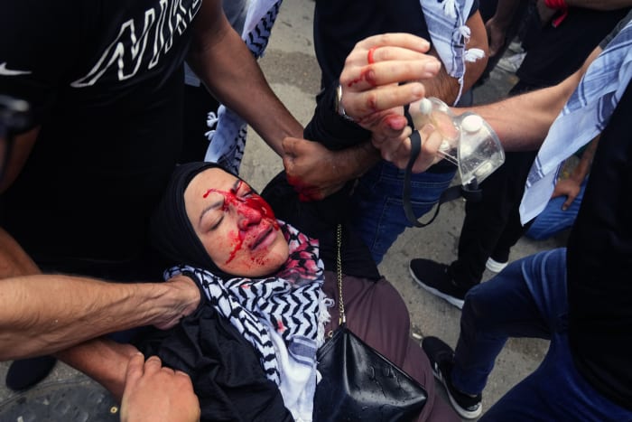 Protesters in Lebanon decrying Gaza hospital blast clash with security forces near U.S. Embassy
