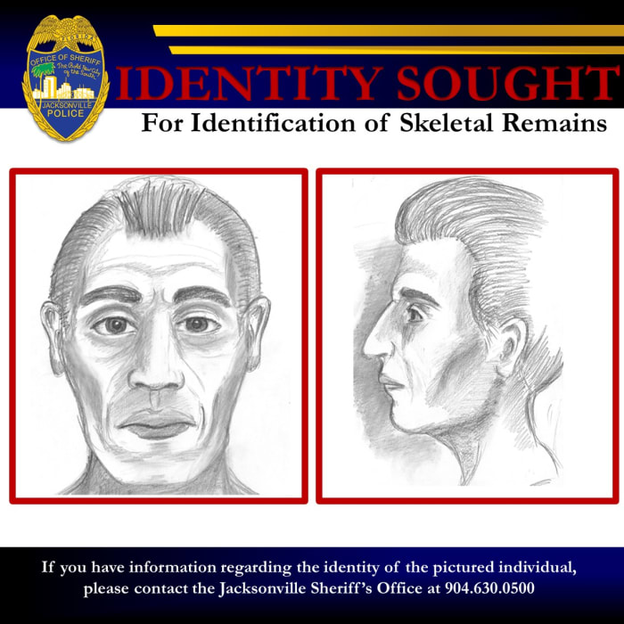 Police release sketch in hopes of identifying skeletal remains Police release sketch in hopes of identifying skeletal remains