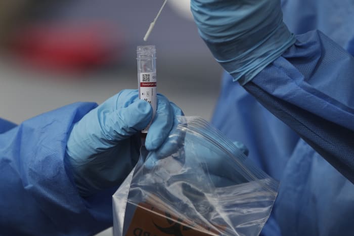 CDC: What to do if you were exposed to COVID CDC: What to do if you were exposed to COVID