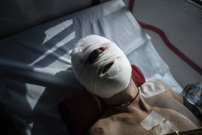 'On tour in hell': Wounded Ukrainian soldiers evacuated