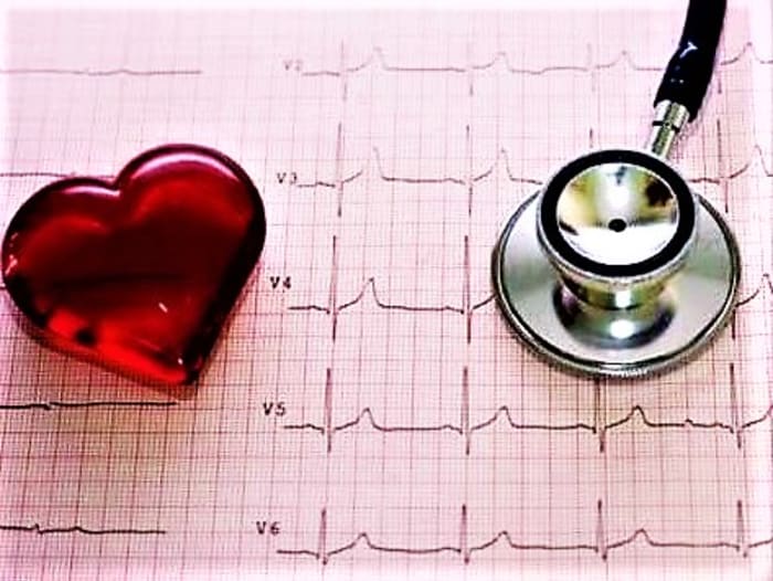 New school year brings mandatory heart screenings for Florida high school athletes