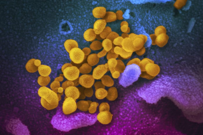 CDC: 1 in 5 adults have health condition that might be linked to COVID illness – WDIV ClickOnDetroit CDC: 1 in 5 adults have health condition that might be linked to COVID illness – WDIV ClickOnDetroit