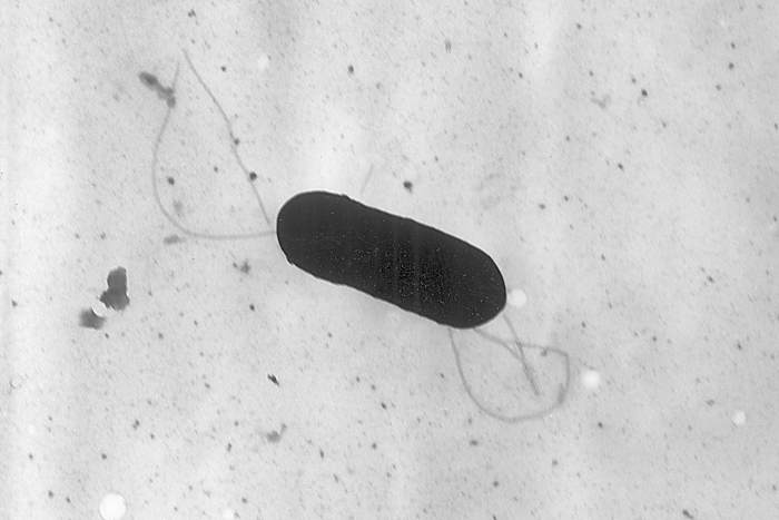 Conocimiento sobre las enfermedades de intoxicación alimentaria causadas por Listeria Conocimiento sobre las enfermedades de intoxicación alimentaria causadas por Listeria
