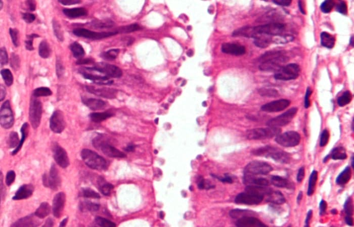 Tweet by AVMA (American Veterinary Medical Association)