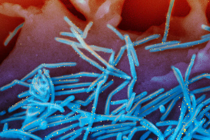 What’s Going Around in Metro Detroit: Influenza, COVID, slip and fall injuries, stomach viruses