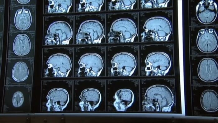 Untersuchungen haben ergeben, dass Optimismus Leben rettet